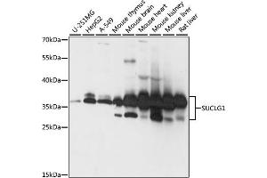 Western blot analysis of extracts of various cell lines, using SUCLG1 antibody (ABIN7270623) at 1:1000 dilution. (SUCLG1 anticorps  (AA 41-346))