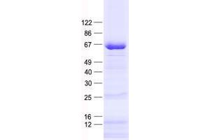 Validation with Western Blot