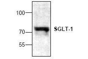 Image no. 1 for anti-Solute Carrier Family 5 (Sodium/glucose Cotransporter), Member 1 (SLC5A1) antibody (ABIN127319) (SLC5A1 anticorps)
