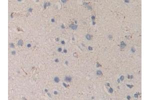 Detection of MAPKAPK2 in Human Cerebrum Tissue using Polyclonal Antibody to MAP Kinase Activated Protein Kinase 2 (MAPKAPK2) (MAPKAP Kinase 2 anticorps  (AA 139-367))