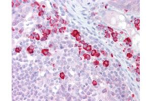 Anti-DAK antibody IHC of human tonsil.