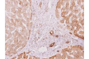 IHC-P Image PRKCSH antibody [N1C1] detects PRKCSH protein at cytoplasm on human normal liver by immunohistochemical analysis. (PRKCSH anticorps)
