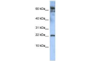 anti-Leucine Zipper, Down-Regulated in Cancer 1 (LDOC1) (N-Term) antibody