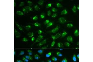 Immunofluorescence analysis of MCF-7 cells using IL7 Polyclonal Antibody (IL-7 anticorps)