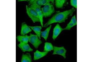 Immunofluorescence (IF) image for anti-Hexokinase 1 (HK1) (AA 1-917), (N-Term) antibody (ABIN317095)