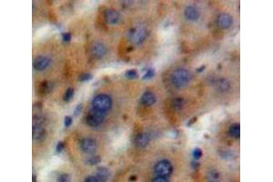 IHC-P analysis of Liver tissue, with DAB staining. (GLN1 anticorps  (AA 1-373))