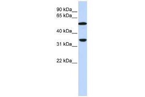Complement C4b antibody used at 1 ug/ml to detect target protein. (C4B anticorps)