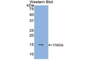 Detection of Recombinant POTEJ, Human using Polyclonal Antibody to POTE Ankyrin Domain Family, Member J (POTEJ) (POTEJ anticorps  (AA 109-269))