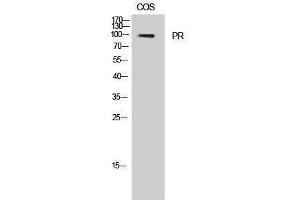 Western Blotting (WB) image for anti-PR (Thr231) antibody (ABIN3177000) (PR (Thr231) anticorps)