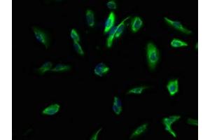 Immunofluorescence staining of U251 cells with ABIN7146342 at 1:100, counter-stained with DAPI.