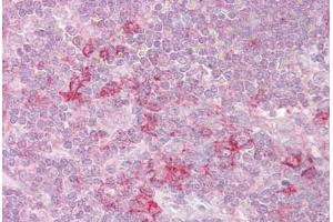 Anti-MST4 antibody IHC staining of human thymus. (STK26/MST4 anticorps  (AA 340-354))