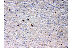 IHC analysis of NSF using anti-NSF antibody .