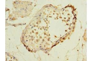 Immunohistochemistry of paraffin-embedded human testis tissue using ABIN7159074 at dilution of 1:100 (MXD3 anticorps  (AA 1-206))