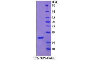 SDS-PAGE analysis of Mouse PDGFC Protein. (PDGFC Protéine)