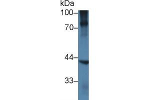 Detection of NKX6-1 in Human BXPC3 cell lysate using Polyclonal Antibody to NK6 Homeobox Protein 1 (NKX6-1) (NKX6-1 anticorps  (AA 1-367))