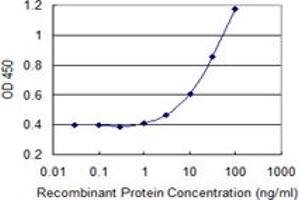 Detection limit for recombinant GST tagged LMO4 is 0.