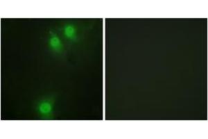 Immunofluorescence analysis of HeLa cells, using NEK9 (Phospho-Thr210) Antibody. (NEK9 anticorps  (pThr210))