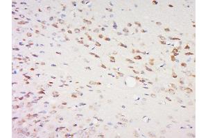 Paraformaldehyde-fixed, paraffin embedded rat brain, Antigen retrieval by boiling in sodium citrate buffer (pH6) for 15min, Block endogenous peroxidase by 3% hydrogen peroxide for 30 minutes, Blocking buffer (normal goat serum) at 37°C for 20min, Antibody incubation with	SPOCK2/Testican 2 Polyclonal Antibody, Unconjugated ( 	 at 1:200 overnight at 4°C, followed by a conjugated secondary and DAB staining.