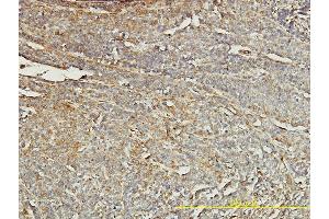 anti-Tropomyosin 4 (TPM4) (AA 1-248) antibody