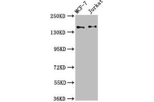 Western Blot Positive WB detected in: MCF-7 whole cell lysate, Jurkat whole cell lysate All lanes: KTN1 antibody at 3. (KTN1 anticorps  (AA 978-1116))
