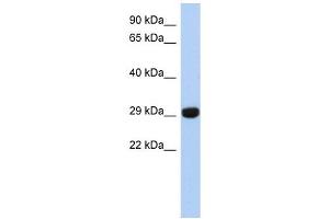 FN3KRP antibody used at 1 ug/ml to detect target protein. (FN3KRP anticorps  (N-Term))