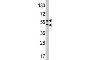 Western blot analysis of CA9 antibody and HeLa lysate.