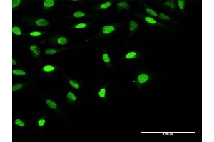 Immunofluorescence of purified MaxPab antibody to OBFC1 on HeLa cell. (OBFC1 anticorps  (AA 1-368))
