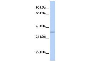 WB Suggested Anti-GRHPR Antibody Titration: 0. (GRHPR anticorps  (N-Term))