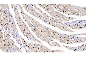 Detection of CTGF in Rat Cardiac Muscle Tissue using Polyclonal Antibody to Connective Tissue Growth Factor (CTGF)