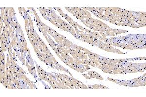 Detection of CTGF in Rat Cardiac Muscle Tissue using Polyclonal Antibody to Connective Tissue Growth Factor (CTGF) (CTGF anticorps  (AA 118-388))