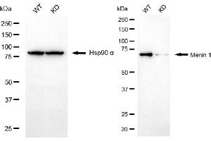 Western blotting analysis using menin 1 antibody (ABIN7799493).