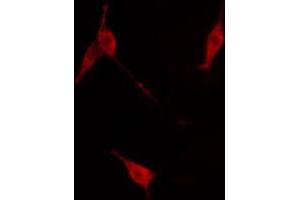 ABIN6267671 staining NIH-3T3 cells by IF/ICC.