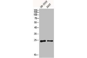 Western blot analysis of SH-SY5Y 293T using Dectin-2 antibody.