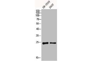 Western blot analysis of SH-SY5Y 293T using Dectin-2 antibody. (C-Type Lectin Domain Family 6, Member A (CLEC6A) (Internal Region) anticorps)