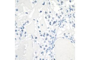 Immunohistochemistry (IHC) image for anti-Hypoxia Inducible Factor 1, alpha Subunit (Basic Helix-Loop-Helix Transcription Factor) (HIF1A) (AA 433-826) antibody (ABIN7453994)
