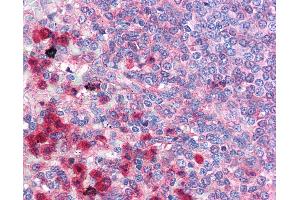 Anti-TRAF6 antibody IHC of human spleen.