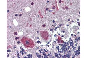 Immunohistochemistry (IHC) image for anti-FEZ Family Zinc Finger 1 (FEZF1) (C-Term) antibody (ABIN2784171)