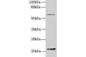 Western blot All lanes: DUSP13 antibody at 4 μg/mL + Hela whole cell lysate Secondary Goat polyclonal to rabbit IgG at 1/10000 dilution Predicted band size: 21, 23, 7, 28, 8, 10, 18 kDa Observed band size: 21 kDa (DUSP13 anticorps  (AA 1-198))