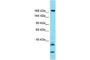 Host:  Rabbit  Target Name:  KIF27  Sample Type:  Large Intestine Tumor lysates  Antibody Dilution:  1. (KIF27 anticorps  (C-Term))
