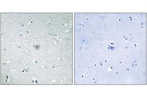 Immunohistochemistry analysis of paraffin-embedded human brain tissue, using PE2R3 Antibody.