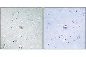Immunohistochemistry analysis of paraffin-embedded human brain tissue, using PE2R3 Antibody. (PTGER3 anticorps  (AA 1-50))