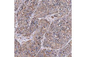 IHC analysis of SERAC1 using anti-SERAC1 antibody (ABIN7602709). (SERAC1 anticorps  (AA 97-623))