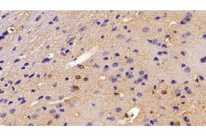 Detection of S100B in Mouse Cerebrum Tissue using Polyclonal Antibody to S100 Calcium Binding Protein B (S100B) (S100B anticorps  (AA 1-92))