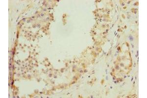 Immunohistochemistry of paraffin-embedded human testis tissue using ABIN7174751 at dilution of 1:100 (C17ORF47 anticorps  (AA 1-300))