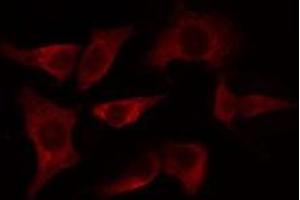 ABIN6275106 staining HeLa cells by IF/ICC. (ELOVL4 anticorps  (Internal Region))