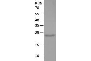Western Blotting (WB) image for Aldehyde Dehydrogenase 3 Family, Member B2 (ALDH3B2) (AA 56-288) protein (His tag) (ABIN7121775) (ALDH3B2 Protein (AA 56-288) (His tag))
