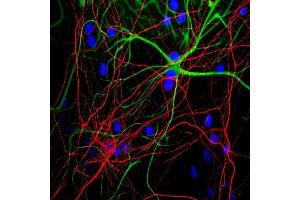Mixed neuron/glial cultures stained with MCA- 9B12 (red) and rabbit GFAP antibody RPCA-GFAP (green).