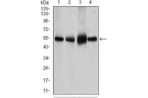 Western Blotting (WB) image for anti-Solute Carrier Family 2 (Facilitated Glucose Transporter), Member 4 (SLC2A4) (AA 224-353) antibody (ABIN1846354)
