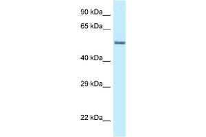 WB Suggested Anti-ZNF384 Antibody Titration: 1. (ZNF384 anticorps  (C-Term))