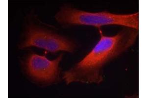 Image no. 1 for anti-Keratin 8 (KRT8) (pSer74) antibody (ABIN401538) (KRT8 anticorps  (pSer74))